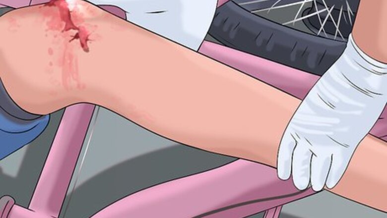 How to Handle Finding a Dead Body