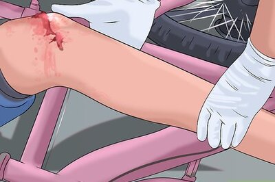 How to Handle Finding a Dead Body