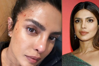 Priyanka Chopra Gets Injured on Heads of State Set, Shares Photo Of Bloodied Forehead | See Here