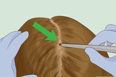 How to Get Rid of Ticks in Your Hair