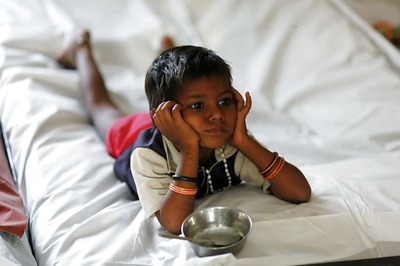 Over 93 Lakh Children in India Suffering from Severe Acute Malnutrition