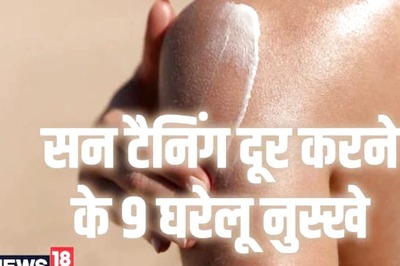 These 9 Home Remedies Will Help You Remove Sun Tan