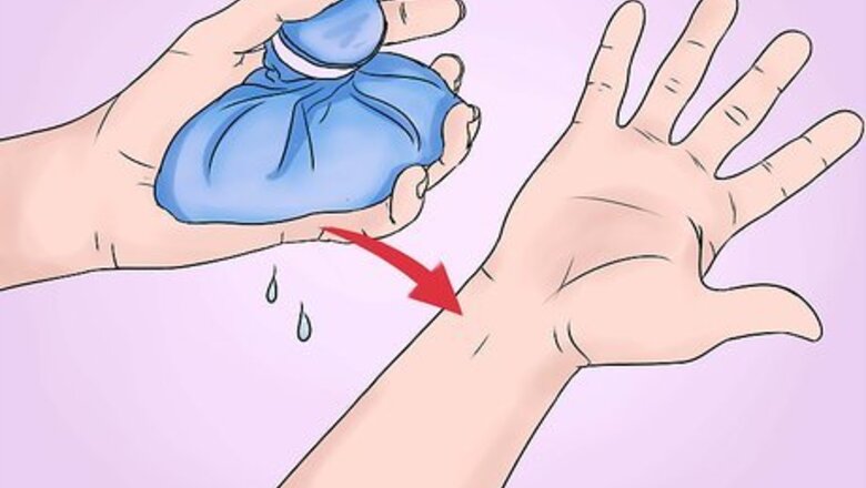 How to Reduce Symptoms of Carpal Tunnel During Pregnancy