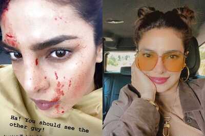 Priyanka Chopra Jonas Shares Blood-splattered Selfie From 'Citadel' Set