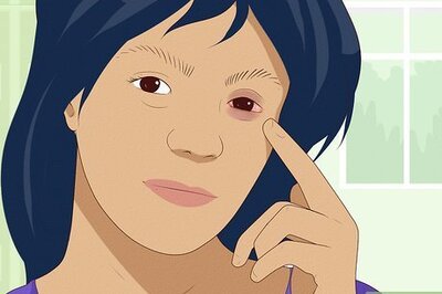 How to Stop Your Eye from Itching