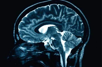 Traumatic Stress Impacts Brains of Boys, Girls Differently