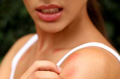 Here’s Why You Are Attracting Mosquitos More Than Others