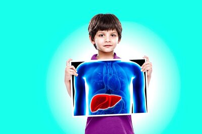 WHO estimates, globally more than 10 Cr people get infected with Hepatitis A every year.