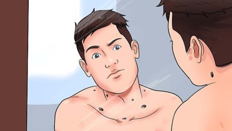How to Examine a Mole