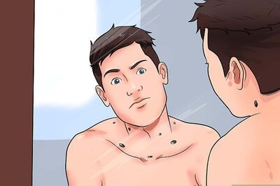 How to Examine a Mole