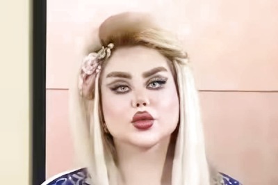 Iraqi Woman Undergoes 43 Surgeries; Here's Why