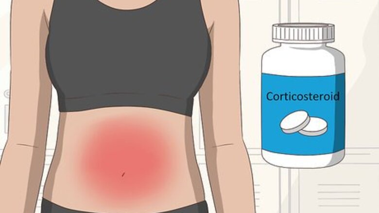 How to Prevent Crohn's Disease