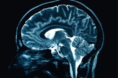 How do people 'come out' of comas?