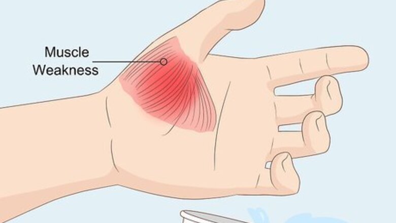 How to Know if You Have a Pinched Nerve