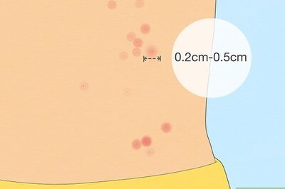 How to Identify Bed Bug Bites