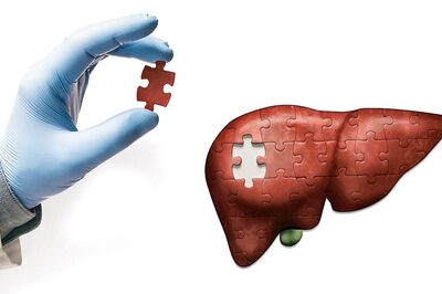 Hepatitis caused by viral infections are preventable