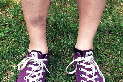 How 'Pokemon Go' Is Injuring Players in Real World