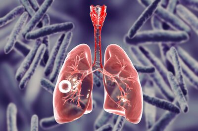 World Tuberculosis Day 2021: Date, Theme, Significance