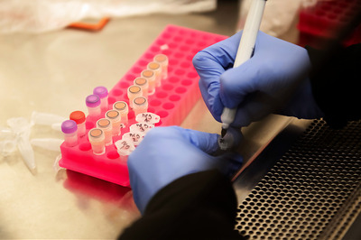 Doctors from AIIMS Defend HCQ Use in Lancet, Say 'Use in High-risk Groups a Prudent Approach'