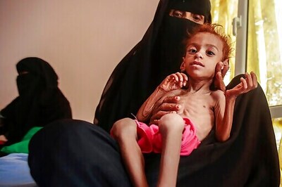 US Resumes Aid To Yemen's Rebel North As Famine Threatens