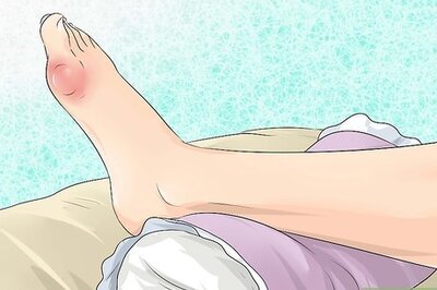 How to Get Gout Relief at Home