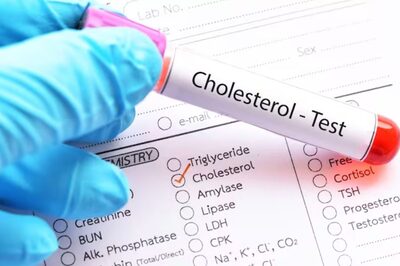 Exercising To Eating Omega-3 Fatty Acid-rich Foods, 5 Ways To Reduce Cholesterol