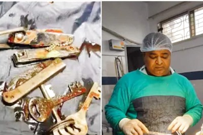 Bihar Boy Swallows Keys, Nail Cutters, Knife Under Addiction For Mobile