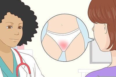 How to Apply Monistat