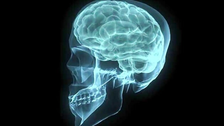 Diabetes drug may restore memory in Alzheimer patients