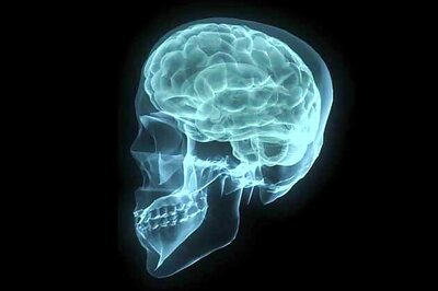 Diabetes drug may restore memory in Alzheimer patients