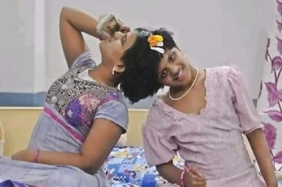 Telangana's Conjoined Twins Defy Odds to Pass Class 10 Exams, Father Sees Dreams of Them Joining IT Industry