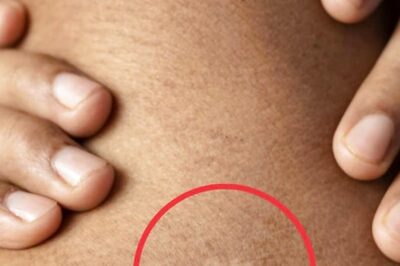 White Patches On Skin? Here’s What It Might Indicate