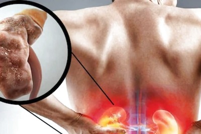 Reduced Blood Flow To Urinary Tract Blockage, Common Causes Of Acute Kidney Injury