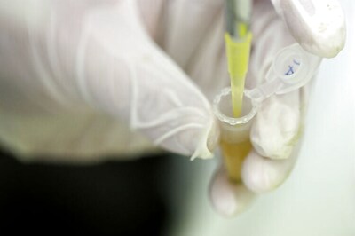 Mini-intestine grown in a test tube