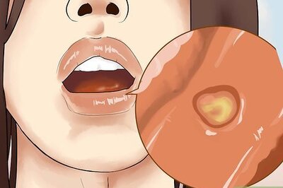 How to Heal Mouth Inflammation