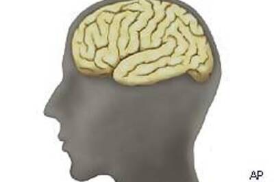 Losing memory? It could be Alzhiemer's