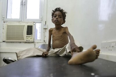 UN Chief Urges Countries to Step up to Prevent Famine in War-torn Yemen