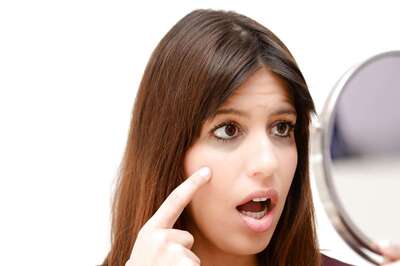 Struggling With Dark Circles Or Puffy Eyes? Nutritionist Suggests 5 Natural Remedies