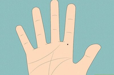What Do Moles on the Hand Mean? An In-Depth Palmistry Guide