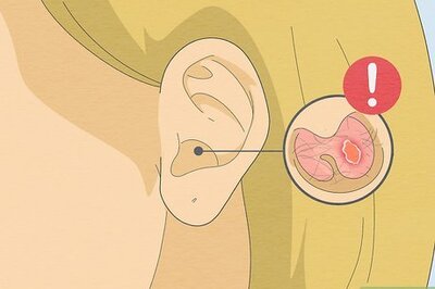 How to Use Ear Candles