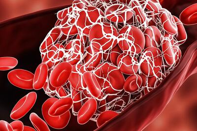 People with Covid History Must Monitor Heart Health, More Prone to Cardiovascular Ailments: Latest Study