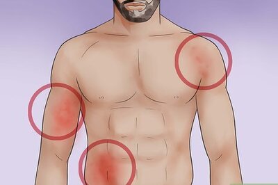 How to Treat Skin Rash