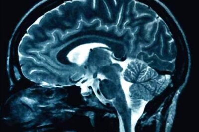 Here's Why Forgetting May Be Good For Your Memory