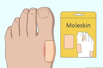 How to Stop a Bunion from Getting Worse