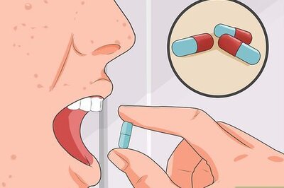 How to Treat Chicken Pox