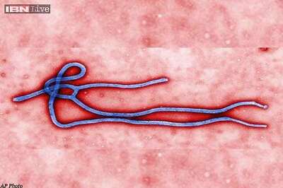 US Government confirms first case of Ebola