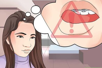 How to Stop Fiddling with Your Braces