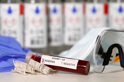 Scientists Develop Method to Reduce Coronavirus Count in Plasma, Blood Products