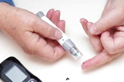 Prediabetes: Its Causes, Symptoms, Prevention And Treatment