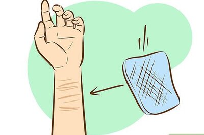 How to Get Rid of Self-Harm Scars
